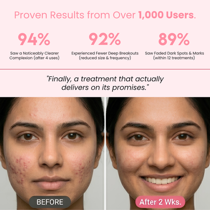 Lumoré 2.0 High Frequency Facial Wand