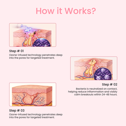 Lumoré 2.0 High Frequency Facial Wand